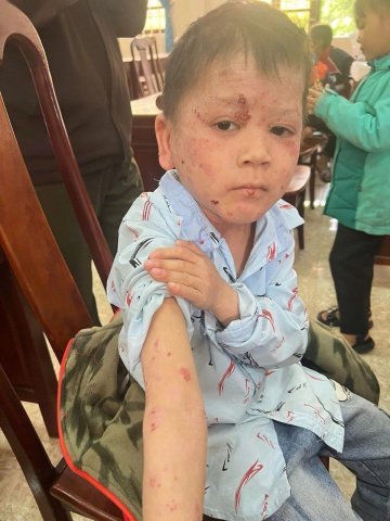 mc_2024_dak_lak_fundraising